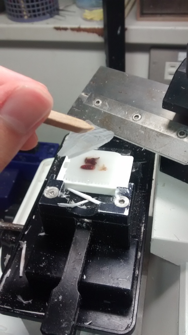 A two micron thick slice of paraffin embedded tissue. Science always amazes me.